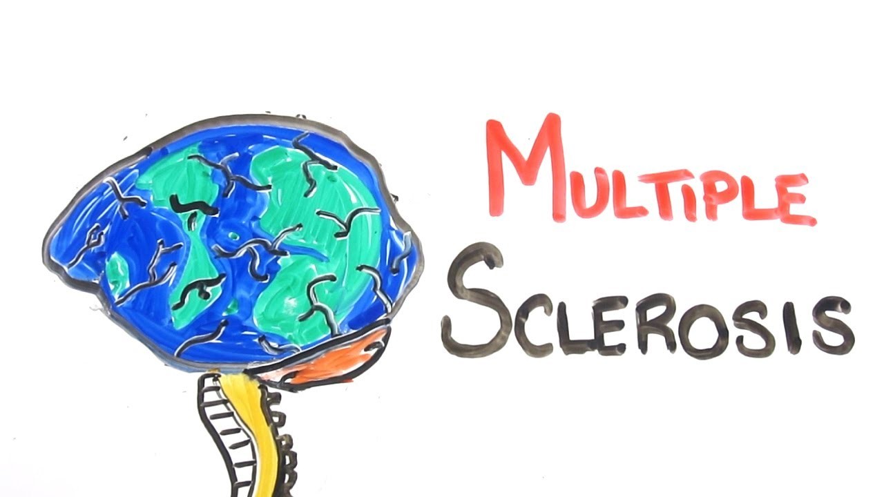 Penyakit multiple sclerosis